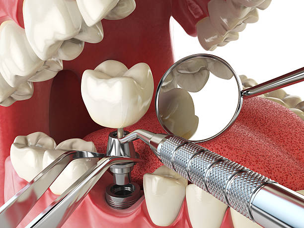 Best Emergency Gum Treatment in Lonville, GA